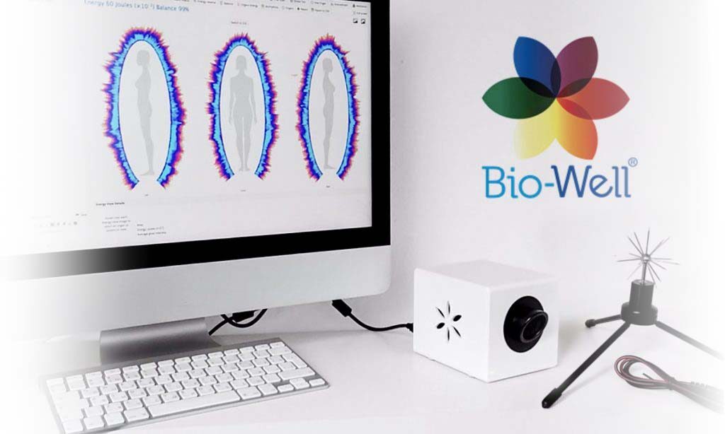 The Bio-Well GDV camera beside a screen of energy field scans